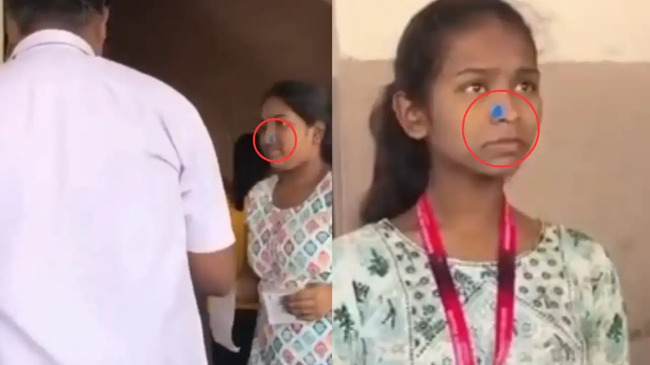 जनेऊ के बाद अब नथ पर मचा बवाल, CET एग्जाम सेंटर पर छत्राओं के नाक पर लगाया टेप