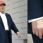 donald trumps hand is covered with a thick layer of makeup photo goes viral