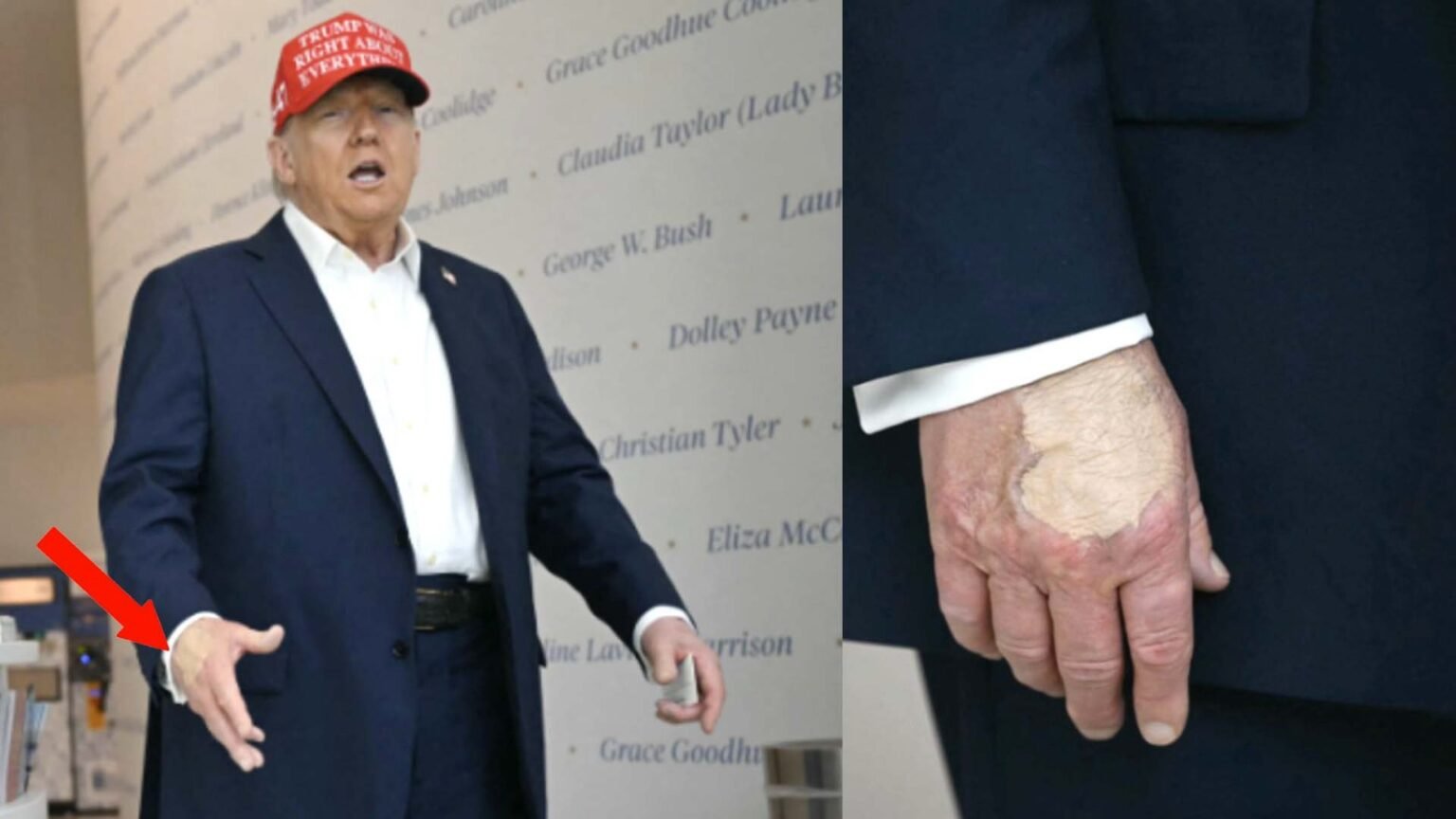 donald trumps hand is covered with a thick layer of makeup photo goes viral