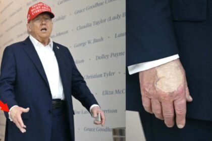 donald trumps hand is covered with a thick layer of makeup photo goes viral