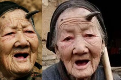 98 year old chinese grandmother cuts forehead horn saved
