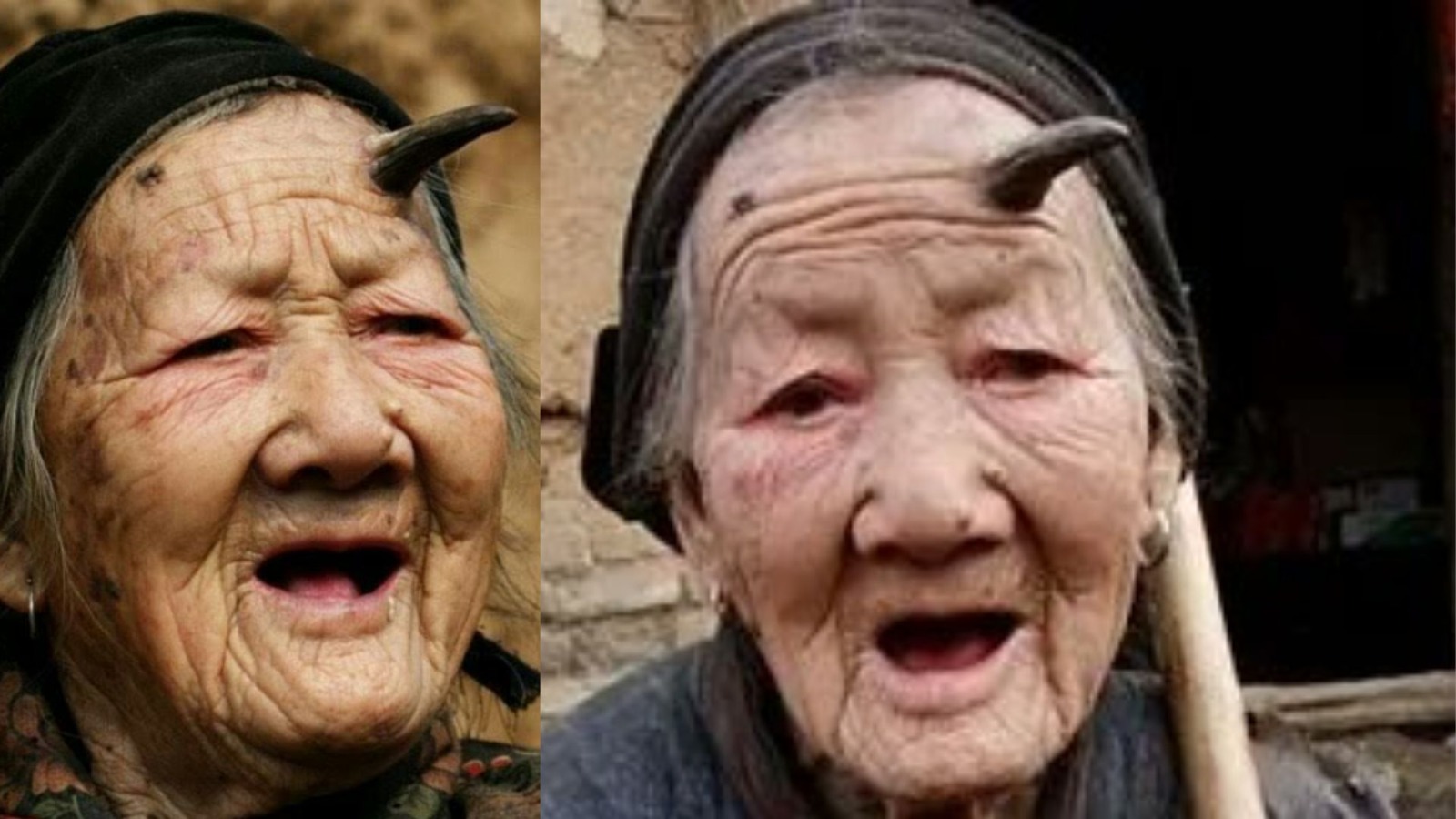 98 year old chinese grandmother cuts forehead horn saved