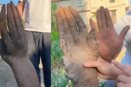 human hand found in field buyers offered over 1 lakh owner refuses to sell
